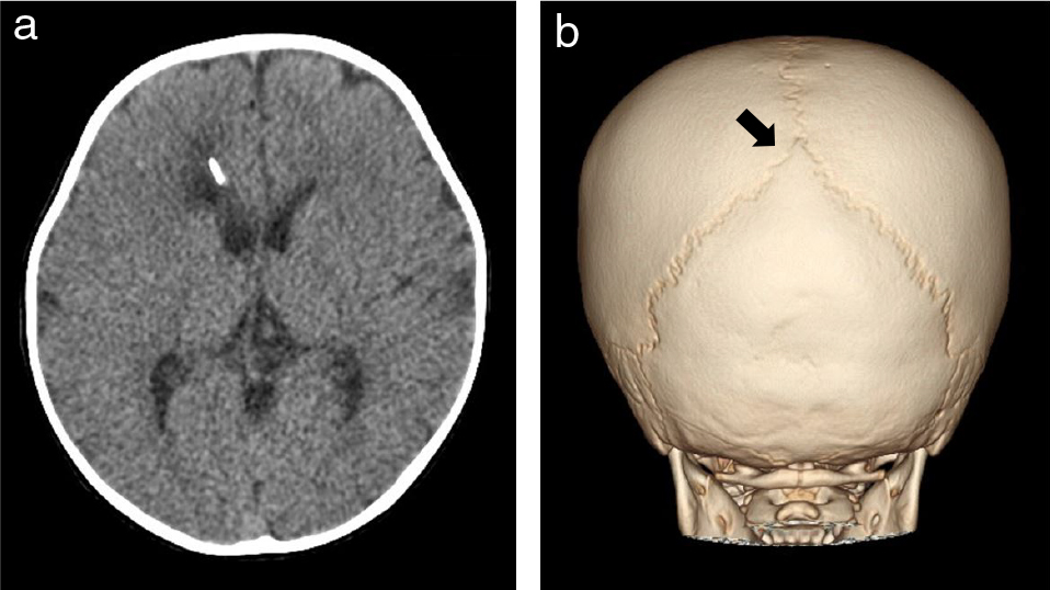 これは珍しい状態ですか?